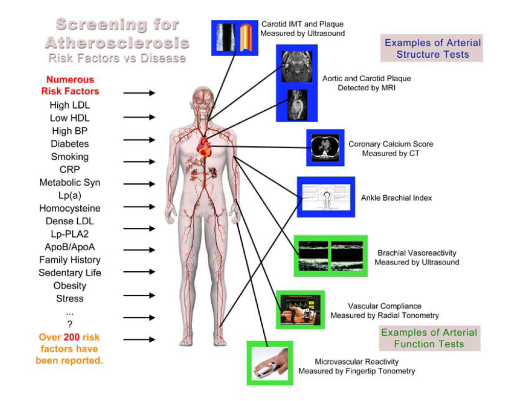 Arterial Structure