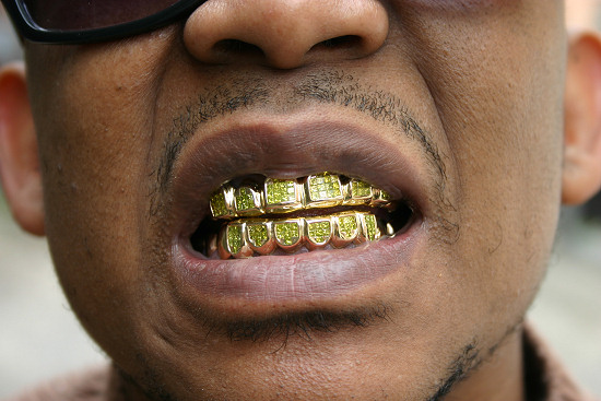 goldteeth.jpg