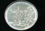 Bacteria found on a Keyboard