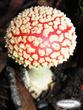 Micronized Itraconazole: Another Topical Choice for Fungal Sinus...