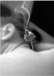 Affordable Acupuncture Greeted with Open Arms by Scottsdale and...