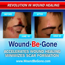 wound be gone