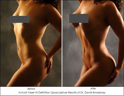 Women+abs+before+and+after