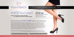 leg spider varicose vein treatment Tampa Bay FL