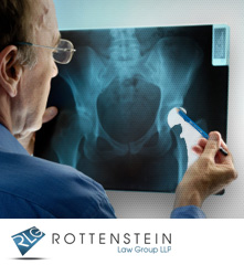 Hip replacement image