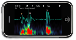 Phonocardiograms show detailed timing and frequency content