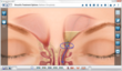 Acclarent and Eyemaginations Collaborate To Promote Patient Education Software