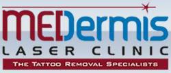 MEDermis Laser Clinic’s Tattoo Removal Contest: Powered by 