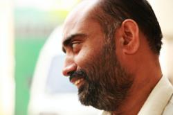 South Asia including Afghanistan, Bangladesh, India, Iran, Nepal, Pakistan, Sri Lanka, hair loss, hairloss, hair loss treatments, hair loss conditions