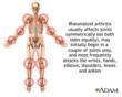 My Arthritis Pain Bye Bye™ - A Solution for your Arthritis Pain