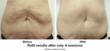 Viora Continues to Show Results with ReFit – a New Concept used to...