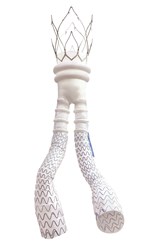 TriVascular Ovation Abdominal Stent Graft System