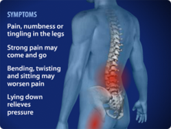 Degenerative Disc Disease Symptoms
