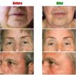 The Look Younger Guarantee, Liberty Health Network's Nonsurgical...