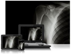 SeeMyRadiology.com Evolves into the De Facto HIE Platform for Imaging