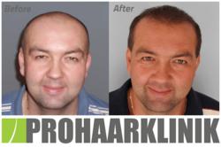 www.prohaarklinik.at