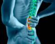 My Pain Bye Bye™ - The Best Solution for Your Back Pain