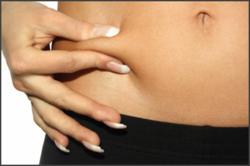 Liposuction