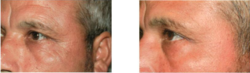 Men and Women can look younger with Beau Visage
