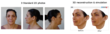 Crisalix Launches the First 3D Imaging System Using 2D Digital...