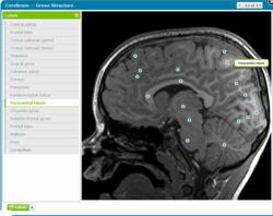 AnatomyOne Gives Clinical Insights through Radiologic Images