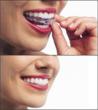Dr. Kananit: Emergency Hospital Visits Related to Preventible Dental...