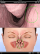 Patient Education Leader Eyemaginations Wins Merit Web Health Award...