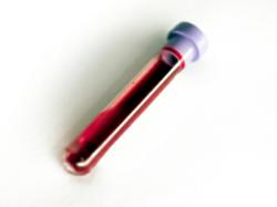 mayo clinic blood serum viscosity test