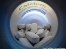 Magnesium deficiencies may prolong life | Dove Medical Press | Clinical Interventions in Aging