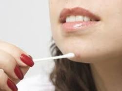 skin tags and mole removal naturally