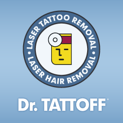 tattoo removal phoenix