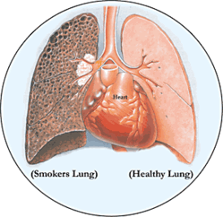 Pulmonary and Critical Care Specialists of Northern Virginia, P.C