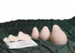 Medex Supply Provides Breast Cancer Self-Exam Aides to Rachael Ray...