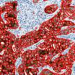 Visiopharm and MetaSystems Announce a Worldwide Distribution Agreement for Quantitative Digital Pathology