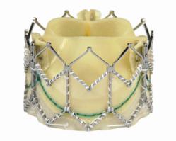 Transcatheter Aortic Valve Implantation (TAVI) Device