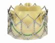 "Advancements in Transcatheter Aortic Valve Implantation (TAVI) Therapy" Webinar Announced By Northwestern Memorial Hospital and HeartValveSurgery.com