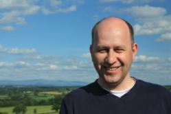 Balding Men | Hair Loss Treatment