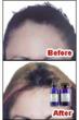 Buy provillus for Women hair Regrowth