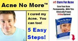 get rid of acne fast