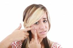 Acne Treatment | Acne Cures at Home
