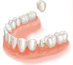 Dentistry @ ScienceIndex.com