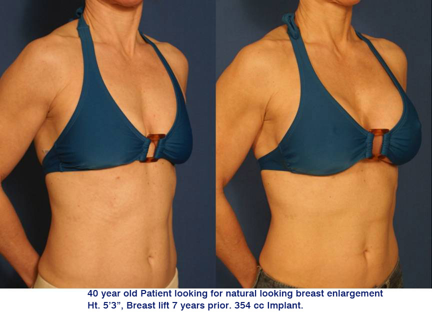 2013 

 Bednar Cosmetic Surgery offers one of the latest ad...