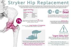 stryker-hip-replacement-infographic