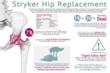 d'Oliveira & Associates Issues Stryker Infographic Providing...