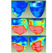 Images from CardioWise, Inc. patent-pending Multiparametric Strain (MPS™) heart analysis software.
