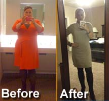 Lap Band Surgery San Antonio Success Story for TBS