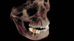 Smile Innovations to offer 3D software for Dental Implants