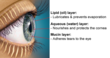 Turner Eye Institute Introduces New Treatment for Evaporative Dry Eye...