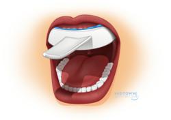 The houston cosmetic dentists use 3M scanner
