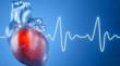 New Granuflo Class Action Lawsuits Filed: Now, AttorneyOne Can Provide...